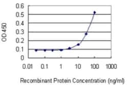 Dimethylarginine Dimethylaminohydrolase 1/DDAH1 Antibody (3F7), Novus Biologicals 0.1 mg | Buy Online | Novus Biologicals | Fisher Scientific