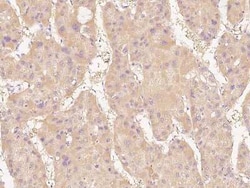 Dimethylarginine Dimethylaminohydrolase 1/DDAH1 Antibody, Novus Biologicals 100 &mu;g | Buy Online | Novus Biologicals | Fisher Scientific