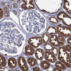 Dimethylarginine Dimethylaminohydrolase 1/DDAH1 Rabbit anti-Human, Polyclonal,