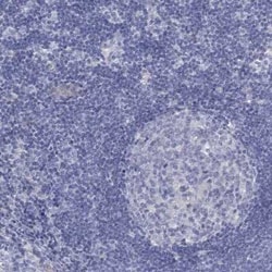 Dimethylarginine Dimethylaminohydrolase 1/DDAH1 Rabbit anti-Human, Polyclonal,