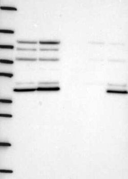 Dishevelled-1 Rabbit anti-Human, Polyclonal, Novus Biologicals:Antibodies:Primary