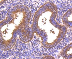 Dkk-1 Rabbit anti-Human, Clone: SC06-86, Novus Biologicals 100&mu;L:Antibodies,
