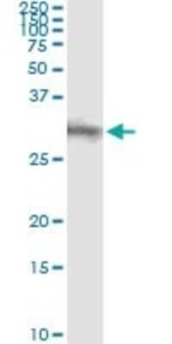 Dkk-1 Antibody (2A5), Novus Biologicals 0.1 mg | Buy Online | Novus Biologicals | Fisher Scientific