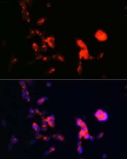Dkk-3 Rabbit anti-Human, Mouse, Rat, Clone: 1R5E0, Novus Biologicals:Antibodies:Primary