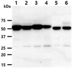 Dkk-3 Mouse anti-Human, Mouse, Clone: 103B5, Novus Biologicals:Antibodies:Primary