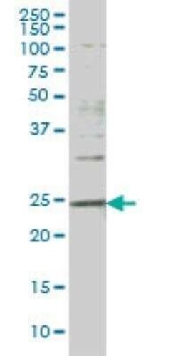 Dlx1 Antibody (2H3), Novus Biologicals 0.1 mg | Buy Online | Novus Biologicals | Fisher Scientific