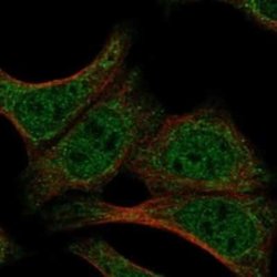 Dnd1 Rabbit anti-Human, Polyclonal, Novus Biologicals 100 &mu;g; Unconjugated:Antibodies,
