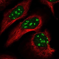 Dnmt2 Antibody, Novus Biologicals 25 &mu;L, Unconjugated:Antibodies, Polyclonal
