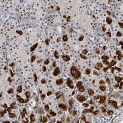 Dnmt2 Antibody, Novus Biologicals 25 &mu;L, Unconjugated:Antibodies, Polyclonal