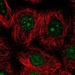Dolichol Kinase Antibody, Novus Biologicals:Antibodies:Primary Antibodies