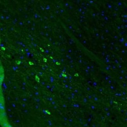 Dopa Decarboxylase/DDC Antibody (CL2962), Novus Biologicals:Antibodies:Primary