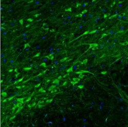 Dopa Decarboxylase/DDC Antibody (CL2962), Novus Biologicals:Antibodies:Primary