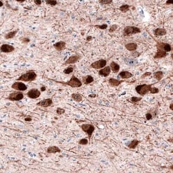 Dopa Decarboxylase/DDC Antibody (CL2962), Novus Biologicals:Antibodies:Primary