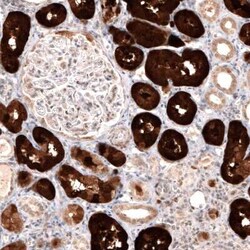 Dopa Decarboxylase/DDC Antibody (CL2962), Novus Biologicals:Antibodies:Primary