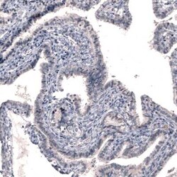 Dopa Decarboxylase/DDC Antibody (CL2962), Novus Biologicals:Antibodies:Primary
