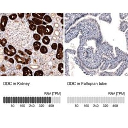 Dopa Decarboxylase/DDC Antibody (CL2962), Novus Biologicals:Antibodies:Primary