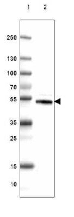 Dopa Decarboxylase/DDC Antibody (CL2962), Novus Biologicals:Antibodies:Primary