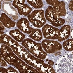 Dopa Decarboxylase/DDC Antibody, Novus Biologicals 0.1 mL | Buy Online | Novus Biologicals | Fisher Scientific