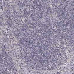 Dopa Decarboxylase/DDC Antibody, Novus Biologicals 0.1 mL | Buy Online | Novus Biologicals | Fisher Scientific