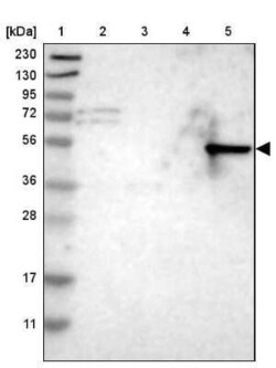 Dopa Decarboxylase/DDC Antibody, Novus Biologicals 0.1 mL | Buy Online | Novus Biologicals | Fisher Scientific
