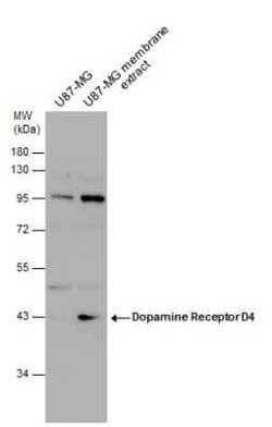 Dopamine Receptor D4 Antibody, Novus Biologicals 100 &mu;g | Buy Online | Novus Biologicals | Fisher Scientific