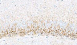 Doublecortin Antibody (BLR168J), Novus Biologicals 100 &mu;g | Buy Online | Novus Biologicals | Fisher Scientific