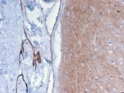 Drebrin 1, Mouse anti-Human, Clone: DBN1/2879, Novus Biologicals 100 ug;