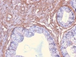 Drebrin 1, Mouse anti-Human, Clone: DBN1/2879, Novus Biologicals 100 ug;