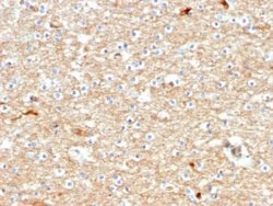 Drebrin 1 Antibody (DBN1/2880) - Azide and BSA Free, Novus Biologicals