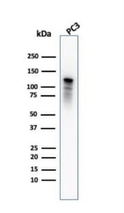 Drebrin 1 Antibody (DBN1/2880) - Azide and BSA Free, Novus Biologicals