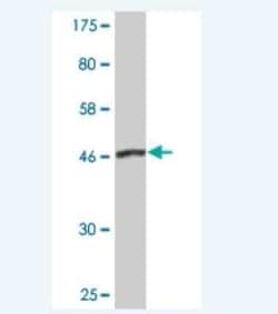 Dynactin Subunit 1/DCTN1 Antibody (2E4-1C2), Novus Biologicals 0.1 mg;