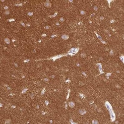 Dynamin Antibody, Novus Biologicals 25 &mu;L, Unconjugated:Antibodies,