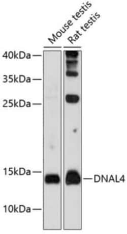 Dynein light chain 4 Antibody - Azide and BSA Free, Novus Biologicals:Antibodies:Primary