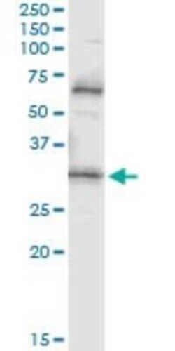 Novus Biologicals Prodynorphin/PDYN Antibody (2E12), Novus Biologicals 0.1 mg | Buy Online | Novus Biologicals&trade; | Fisher Scientific