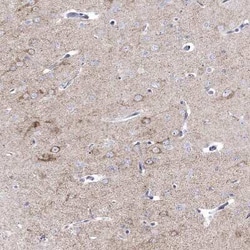 Prodynorphin/PDYN Antibody, Novus Biologicals 25 &mu;L, Unconjugated:Antibodies,