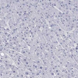 Prodynorphin/PDYN Antibody, Novus Biologicals 25 &mu;L, Unconjugated:Antibodies,