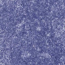 Prodynorphin/PDYN Antibody, Novus Biologicals 25 &mu;L, Unconjugated:Antibodies,