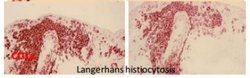 Dystonin Antibody (H5E.Hy.4B), Novus Biologicals 0.1mg; Unlabeled:Antibodies,
