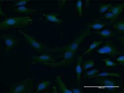 Dystrobrevin alpha Antibody, Novus Biologicals 0.05 mg | Buy Online | Novus Biologicals | Fisher Scientific