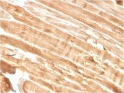 Dystrophin Mouse anti-Human, Clone: DMD/3244, Novus Biologicals 20 &mu;g;