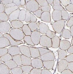 Dystrophin Antibody, Novus Biologicals:Antibodies:Primary Antibodies