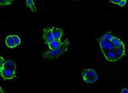 E-Cadherin Rabbit anti-Human, Clone: 32, Novus Biologicals 50 &mu;g; Unconjugated:Antibodies,