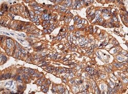 E-Cadherin Rabbit anti-Human, Clone: 32, Novus Biologicals 50 &mu;g; Unconjugated:Antibodies,