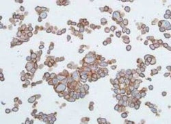 E-Cadherin Antibody (BLR088G), Novus Biologicals 100 &mu;g | Buy Online | Bio-Techne | Fisher Scientific