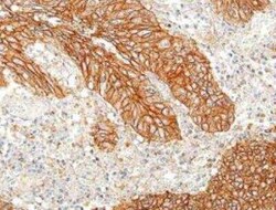 E-Cadherin Antibody (BLR088G), Novus Biologicals 100 &mu;g | Buy Online | Bio-Techne | Fisher Scientific