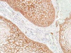 E-Cadherin Antibody (BLR088G), Novus Biologicals 100 &mu;g | Buy Online | Bio-Techne | Fisher Scientific