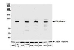 E-Cadherin Antibody (BLR088G), Novus Biologicals 100 &mu;g | Buy Online | Bio-Techne | Fisher Scientific
