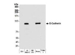 E-Cadherin Antibody (BLR088G), Novus Biologicals 100 &mu;g | Buy Online | Bio-Techne | Fisher Scientific