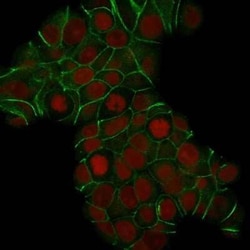 E-Cadherin Antibody (CDH1/1525), Novus Biologicals:Antibodies:Primary Antibodies