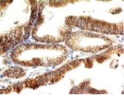 E-Cadherin Antibody (CDH1/1525), Novus Biologicals:Antibodies:Primary Antibodies